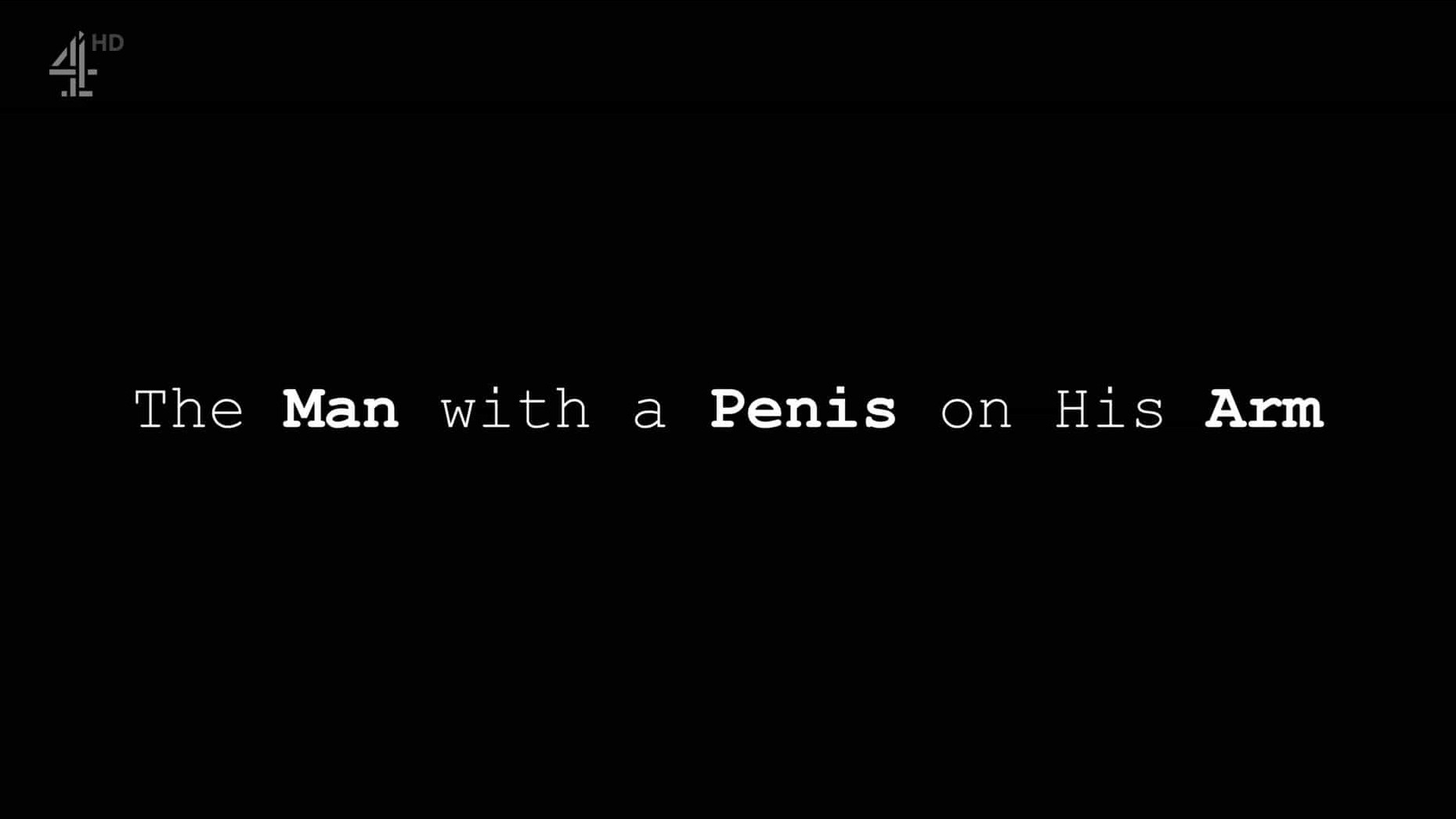 CH4纪录片/器官移植《手臂上长阴茎的男人 The Man with a Penis on his Arm 2022》全1集 英语英字 1080P高清下载 