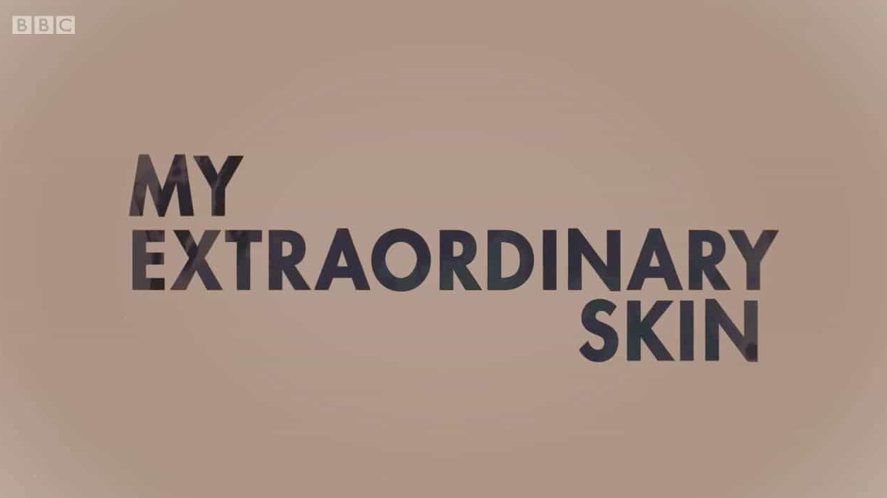 BBC纪录片《白癜风—我的特殊皮肤 Radio Stories My Extraordinary Skin 2017》全1集 英语英字 720p高清网盘下载 