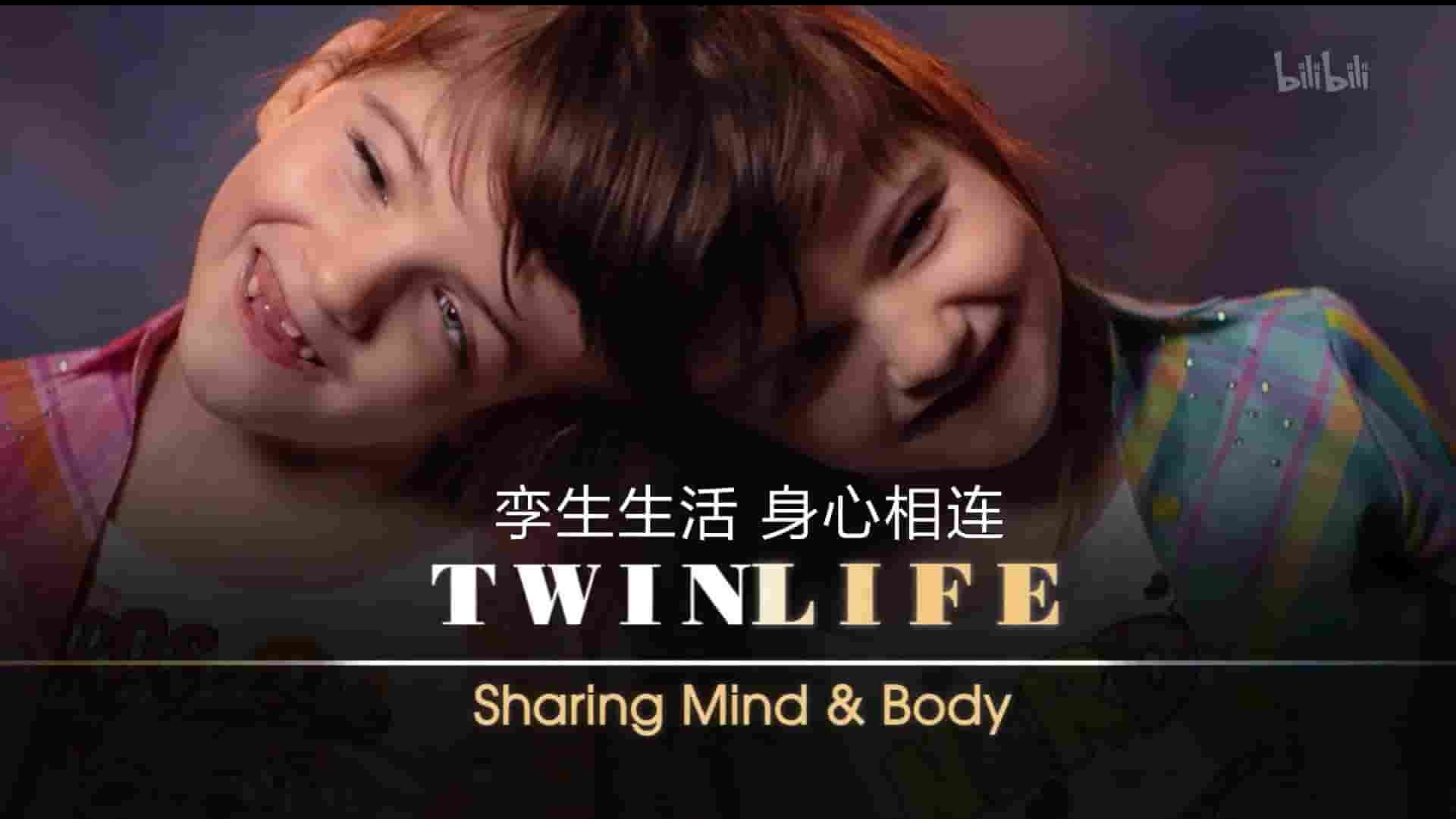 美国纪录片《孪生生活 身心相连 Twin Life: Sharing Mind and Body 2014》全1集 英语中英双字 1080P高清网盘下载