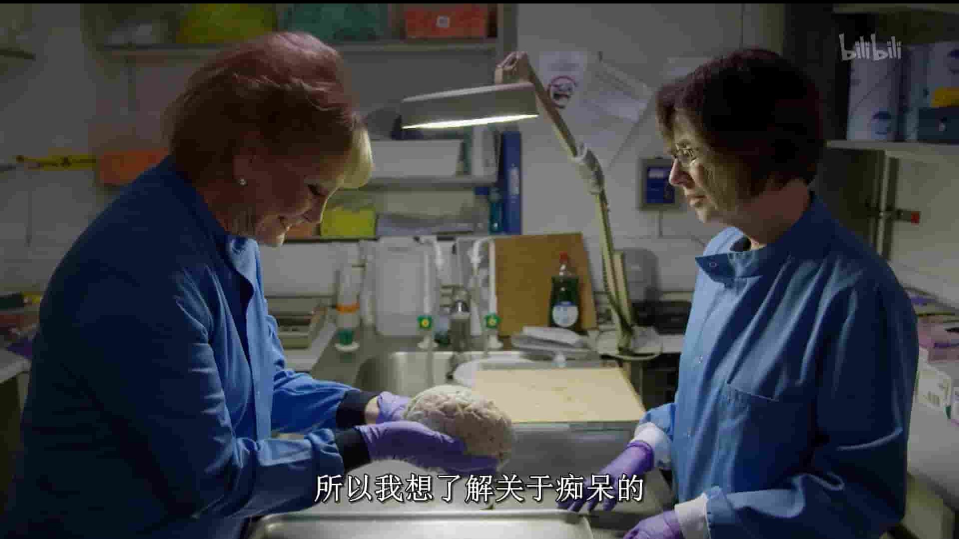 BBC纪录片《痴呆的真相 The Truth About Dementia 2016》全1集 英语中字 1080P高清网盘下载