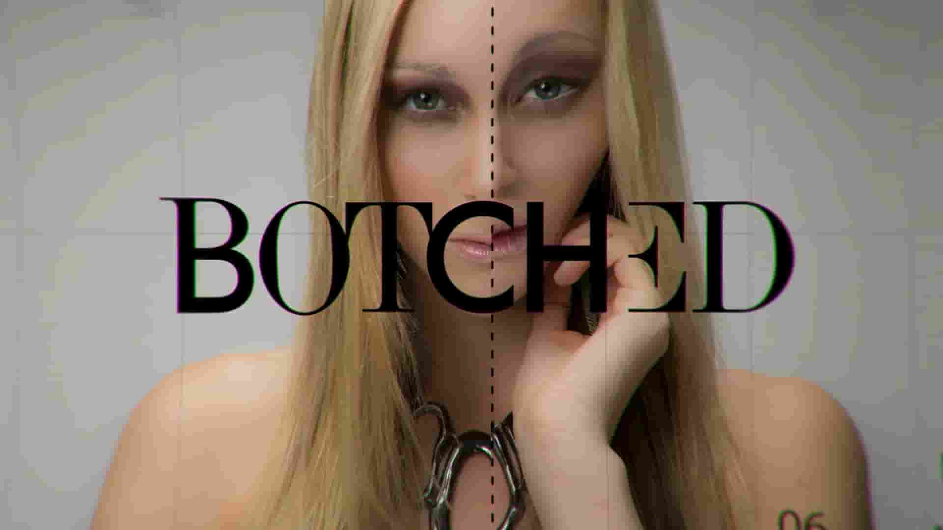 Netflix纪录片《拯救失败整形术 Botched 2014》第1季全10集 英语中英双字  1080P高清网盘下载