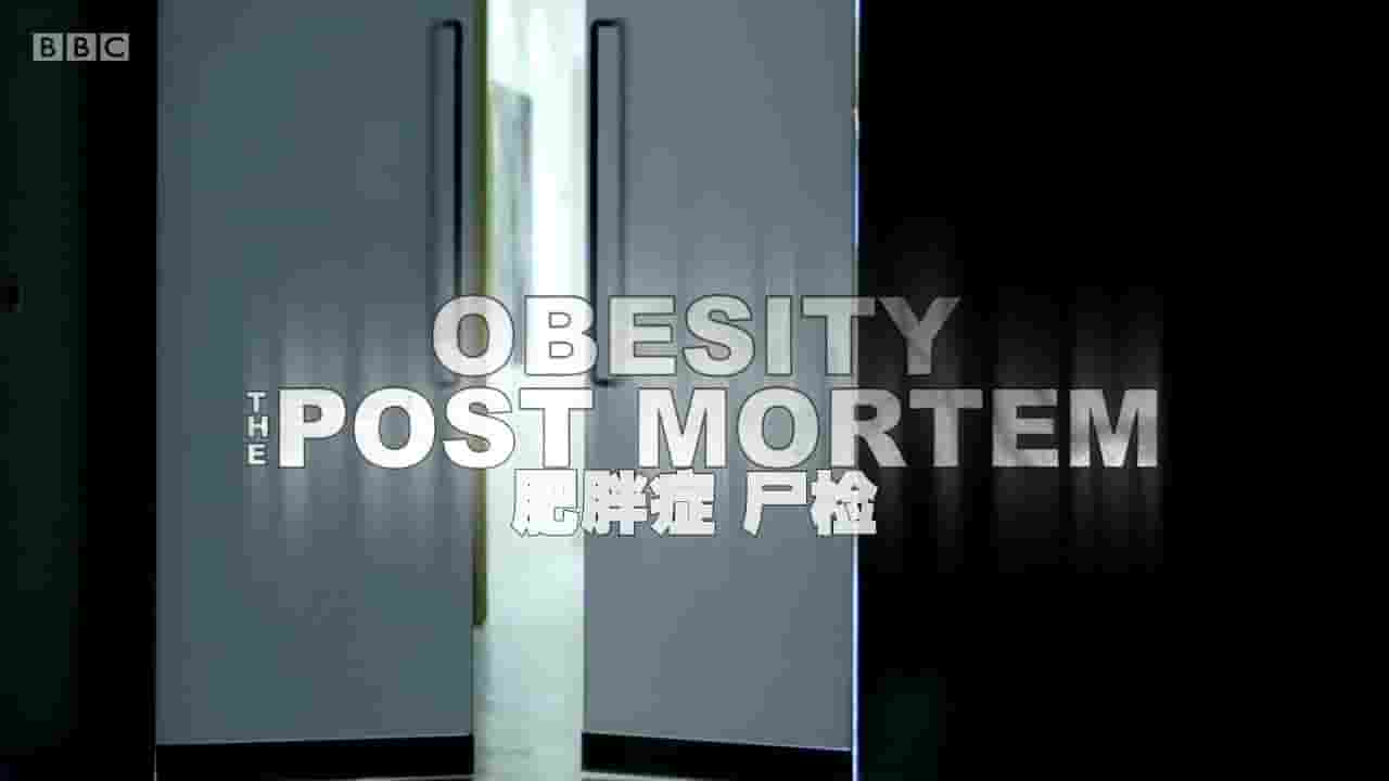 BBC纪录片《解剖肥胖/肥胖症：尸检 Obesity: The Post Mortem 2016》全1集 英语内嵌中英双字 720P高清网盘