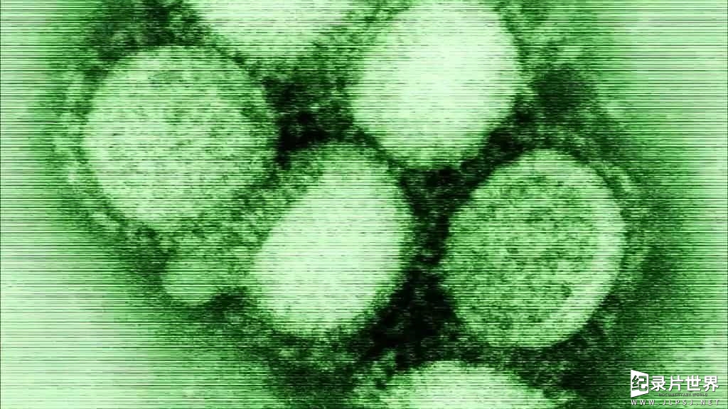 BBC纪录片/地平线系列《病毒为何致命 Why Do Viruses Kill 2010》全1集