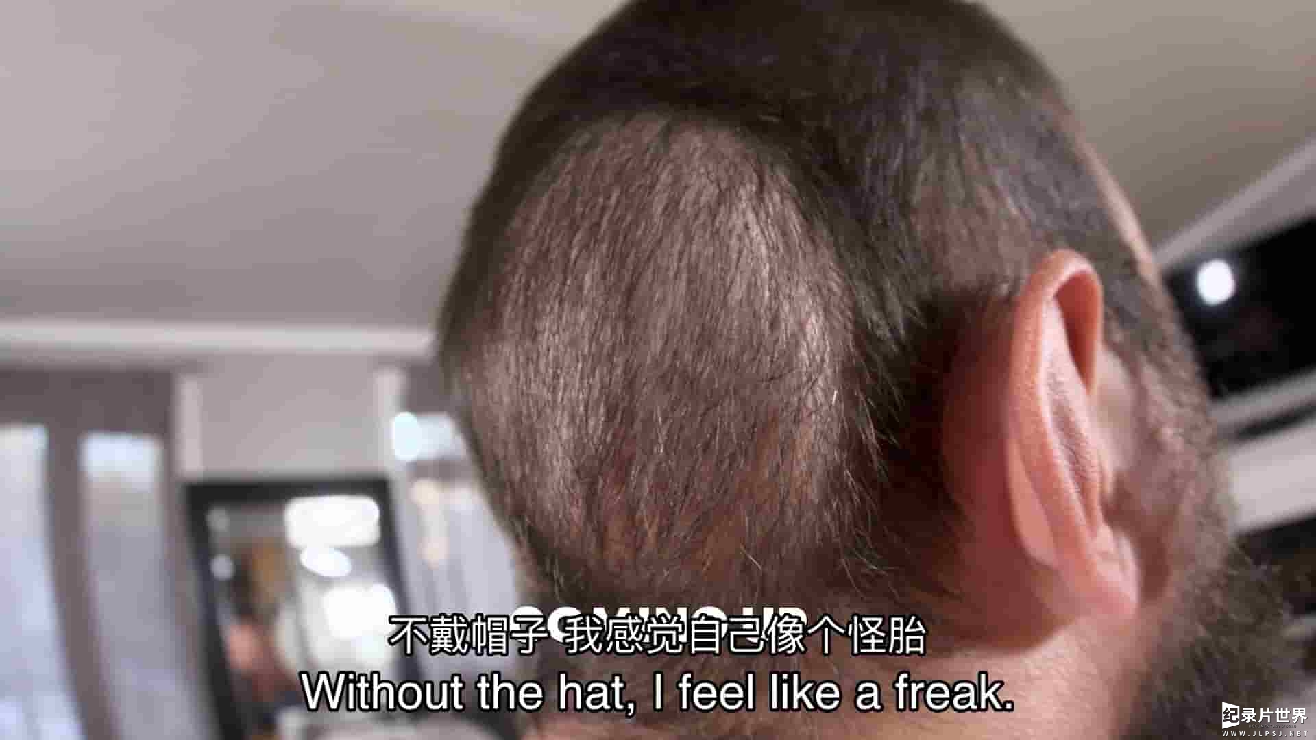 TLC纪录片《挤痘大师/战痘医师 Dr. Pimple Popper 2023》第9季全10集