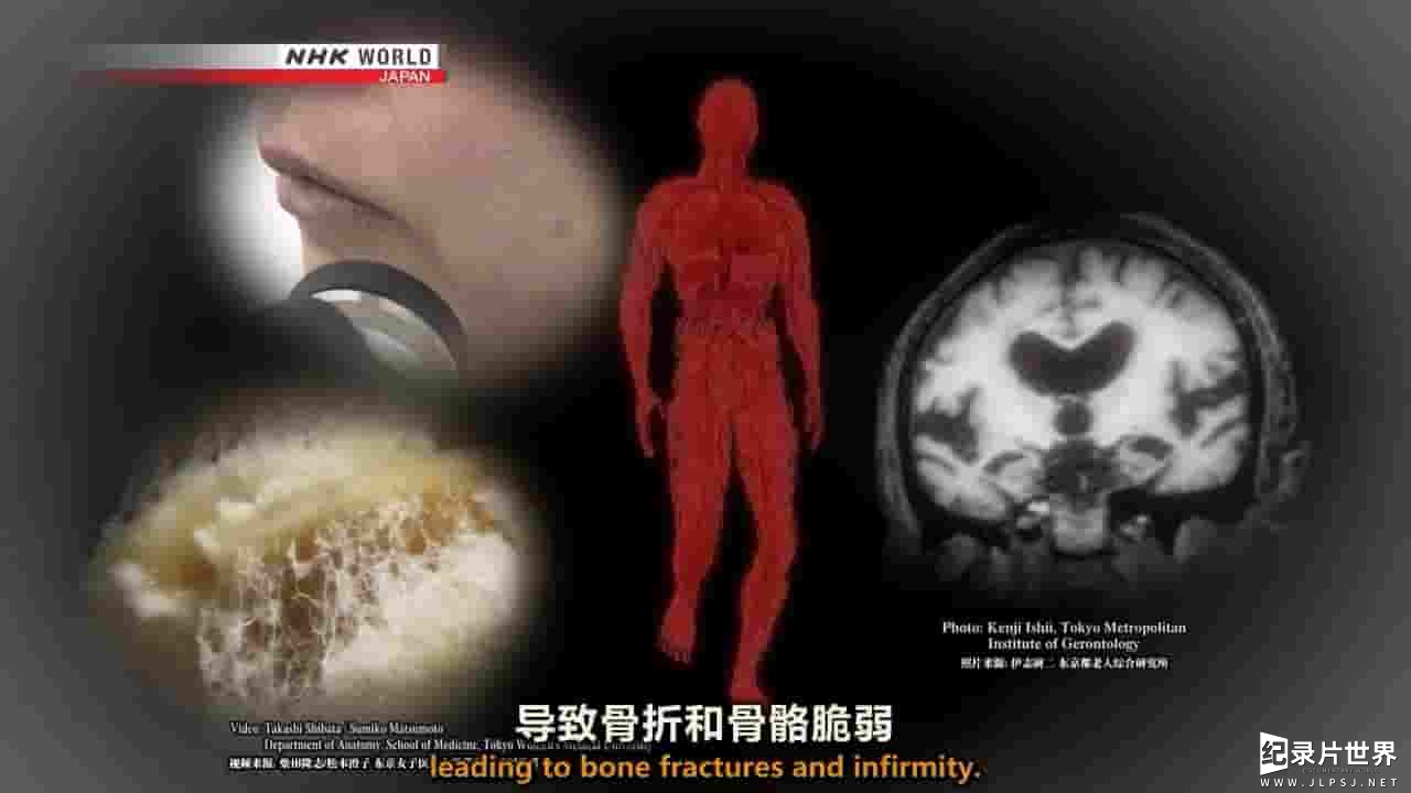 NHK纪录片《幽灵血管 Ghost Blood Vessels 2018》全1集