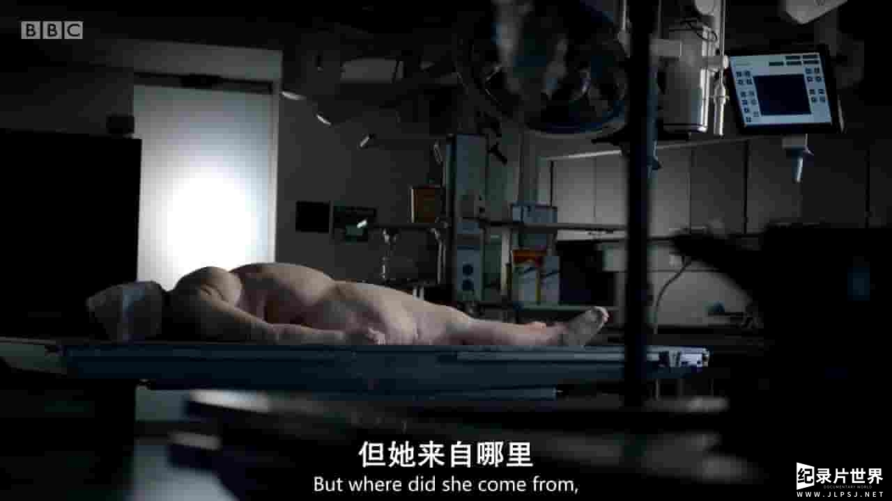 BBC纪录片《解剖肥胖/肥胖症：尸检 Obesity: The Post Mortem 2016》全1集 